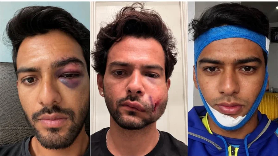 From Century To Horror Injury In 24 Hours: Fomer India Star Shares Update | WATCH
